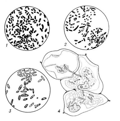 Азотфиксирующие микроорганизмы: 1 — Azotobacter vinelandii; 2 — Clostridium pasterianum; 3 — Rhizobium meliloti; 4 — клубеньковые бактерии в клетках корня ольхи. Азотфиксирующие микроорганизмы.