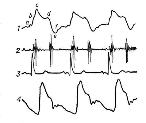  (1)  ,     ;  (2),  (3)     (4).   :    ; b    ;     ; d    ;    - ; f    (   ).