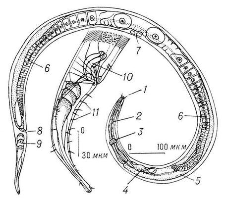 . 1.    Axonolaimus paraspinosus:     ;      ; 1   ; 2  ; 3   ; 4   ; 5  ; 6   ; 7    ; 8  ; 9   ; 10  ; 11   .