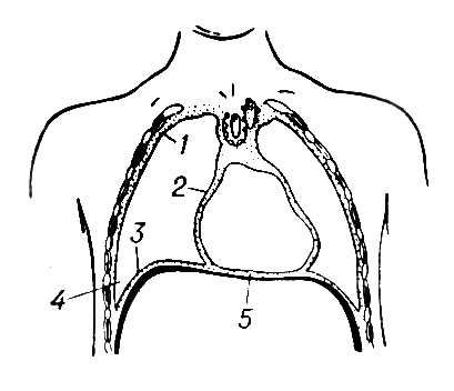      (): 1   ; 2   ; 3   ; 4  - ; 5  .